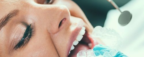 Dlaczego tak trudno jest nam utrzymać biel naszych zębów?