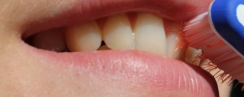 Higienizacja jamy ustnej – zabiegi niezbędne do zachowania zdrowych zębów