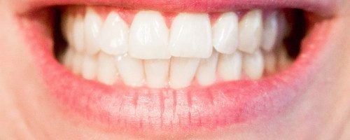 Na czym polega higienizacja zębów?
