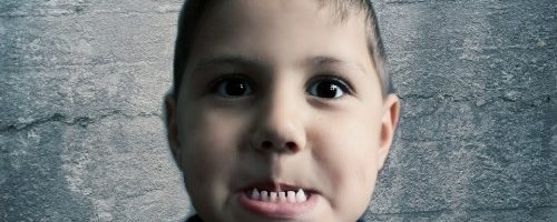 Próchnica w zębach mlecznych – co powinni wiedzieć rodzice?