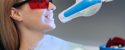 Wybielanie zębów z aparatem ortodontycznym – czy to możliwe?