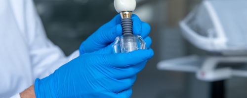 Implanty zębowe a rezonans magnetyczny – co warto wiedzieć?